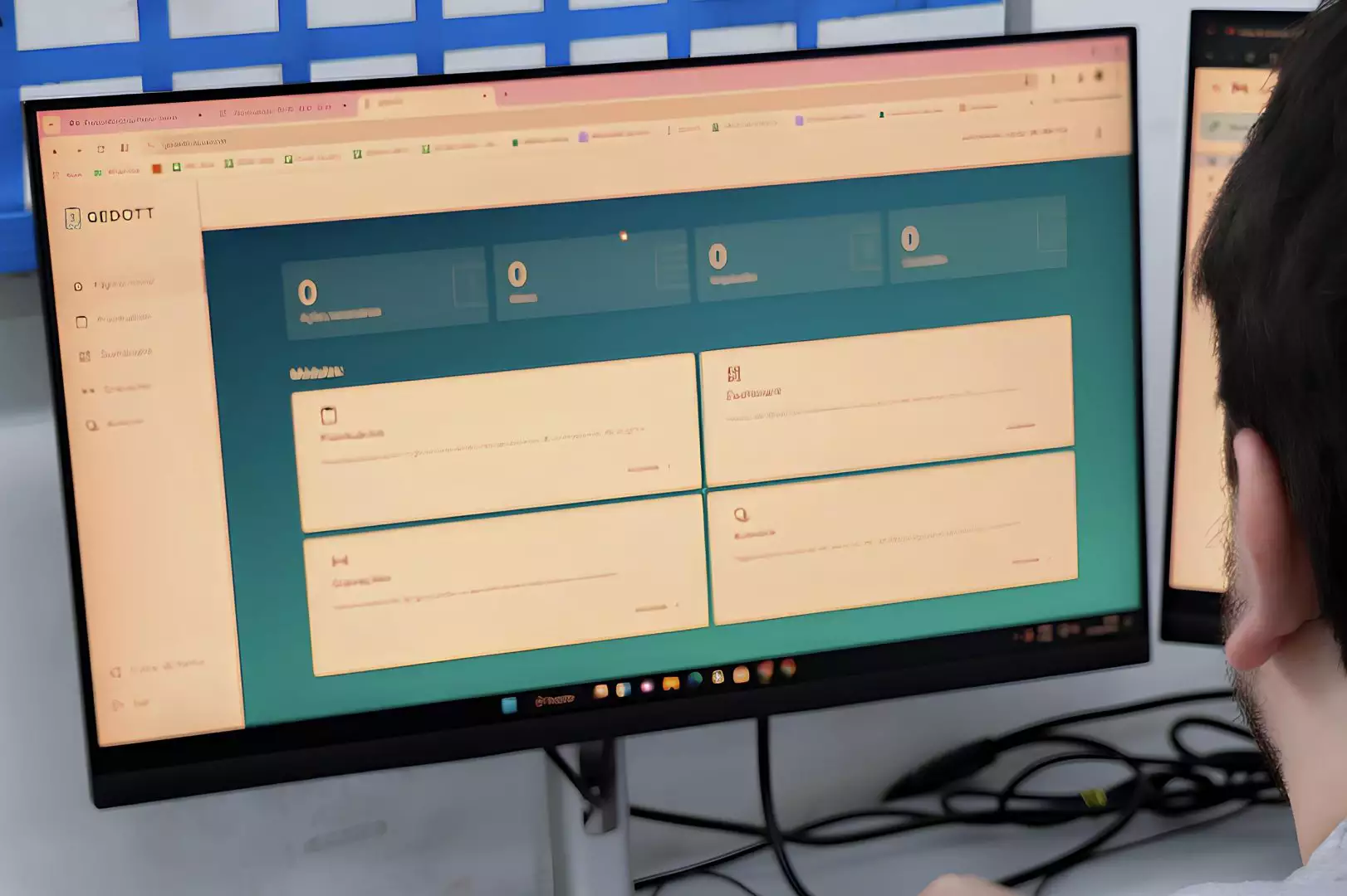 Plataforma de IA agiliza decisões em transplantes e melhora fluxo de atendimento